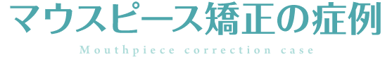 マウスピース矯正の症例