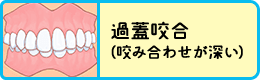 過蓋咬合（咬み合わせが深い）